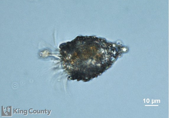 Photo of Tintinnopsis
